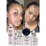 Dandelion Brightening Skin Care Set Removes Blemishes Moisturizes and Glows